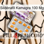 Sildénafil Kamagra 100 Mg new12